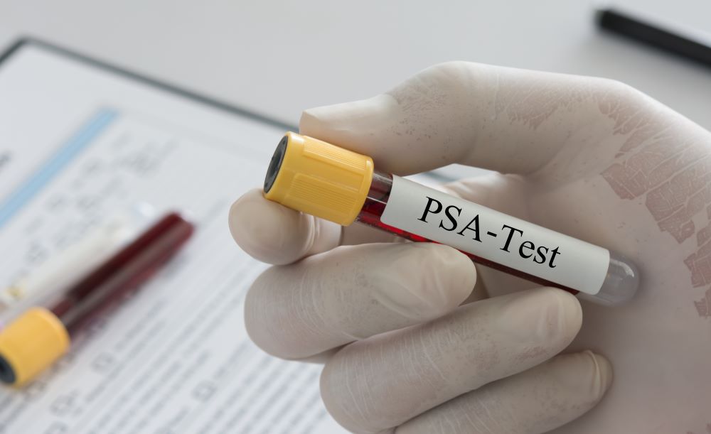 Blutprobe für PSA-Test