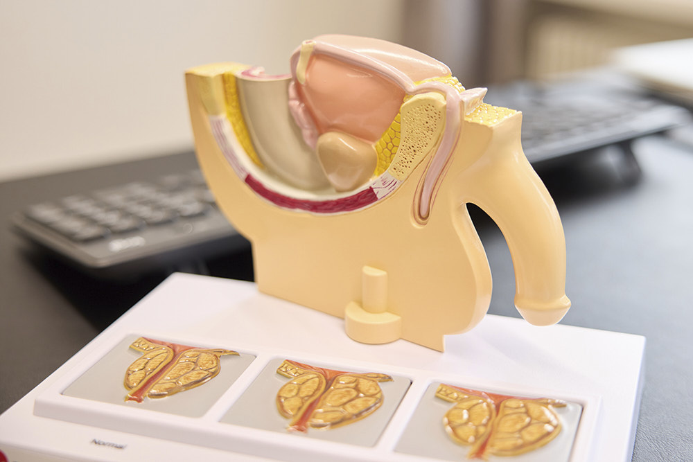 Männliche Geschlechtsorgane neu | Urologie Aarau